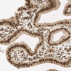 RNF113A Antibody, Novus Biologicals 0.1 mL | Buy Online | Novus Biologicals | Fisher Scientific